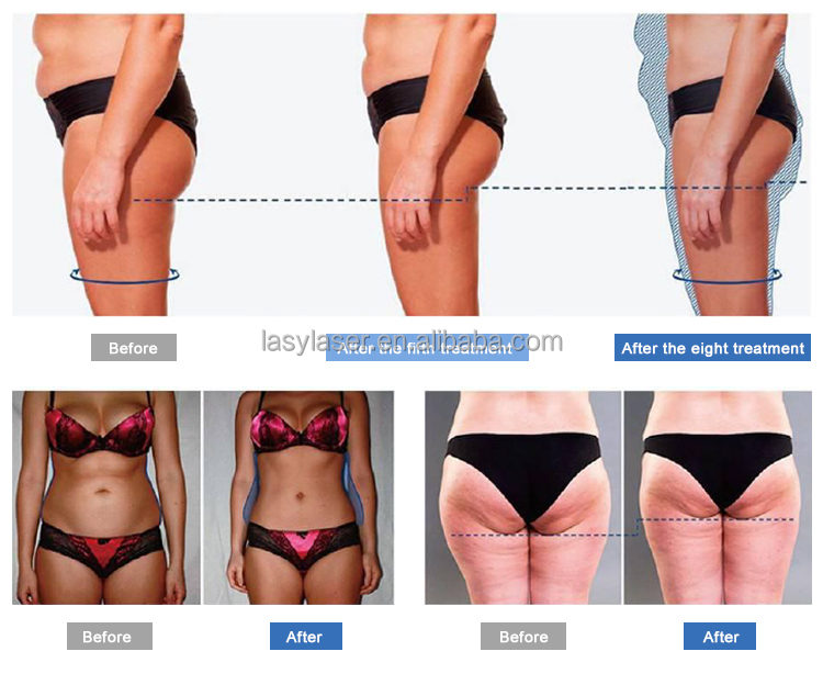 High Frequency Non Invasive EMS Body Sculpting Machine 800w Hiemt Muscle Machine