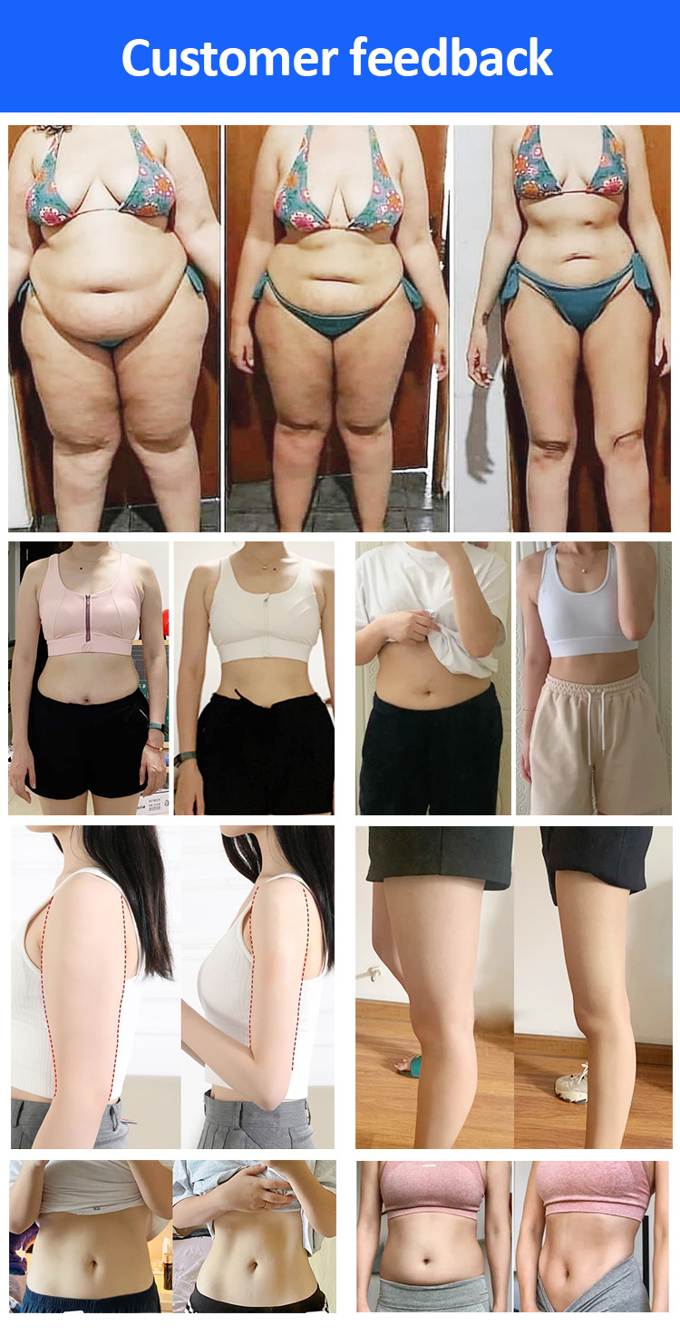 EMS Cooling Beauty Therapy Machine Fat And Cellulite Reduction Machine