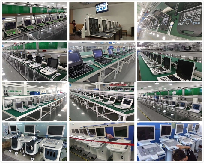 Xianfeng Pregnancy Color Doppler Ultrasound Machines Images 4B OEM 9