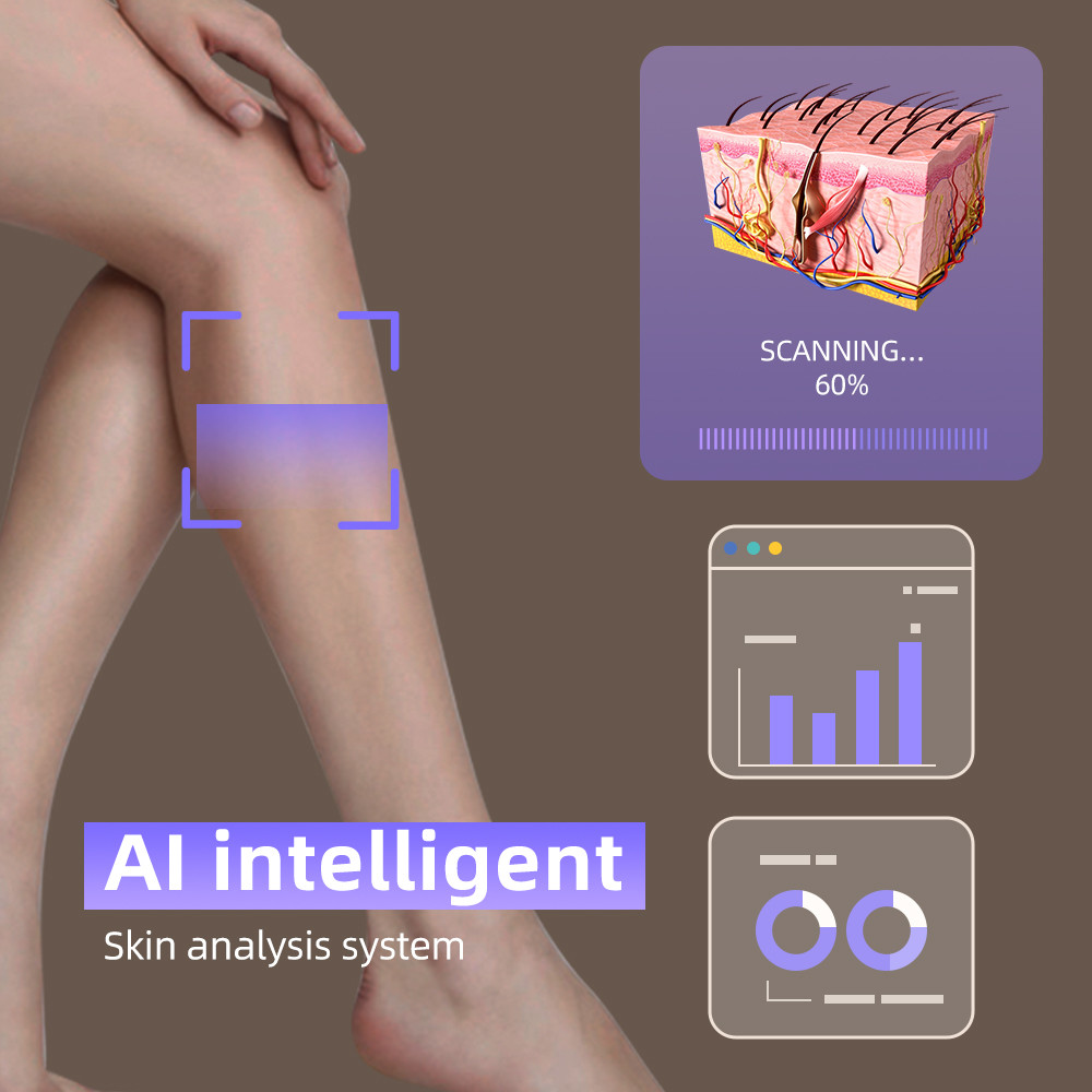 Superior Laser Hair Removal Machine with 808nm/755 808 1064 940 Wavelength and 1-10Hz Shot Frequency
