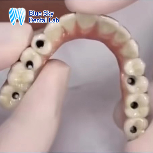 Implant Operation Cases / Implant Procedure Cases for Diverse Implant Choices and Sterilizations