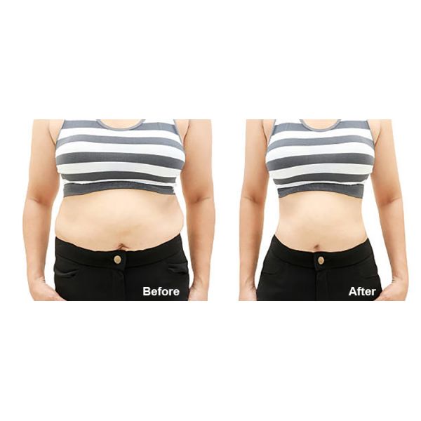 Cold Hammer Tecar RF Machine Radio Frequency Diathermy Face Lift Machine