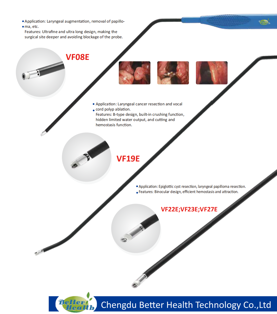 RF Plasama Surgery System Thyroid Tumor laryngology Surgery Surgical Instrument