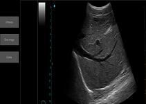 Ultrasound Scan Equipment Portable Ultrasound Scanner Palm Ipad Ultrasound Machine