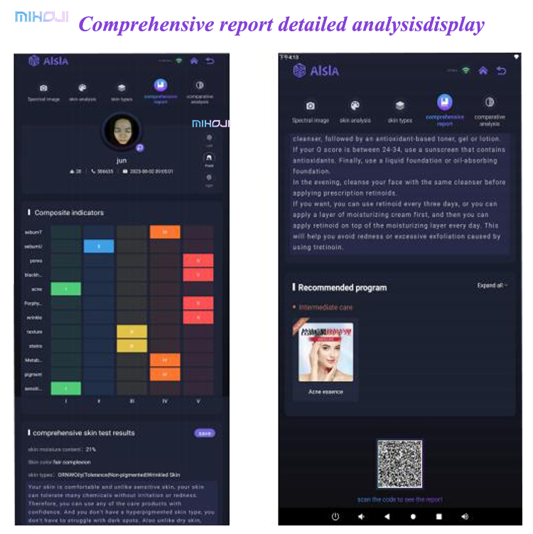 Effective Acne Treatment with Q1 Q2 Skin Analysis Machine and Pigmentation Analysis