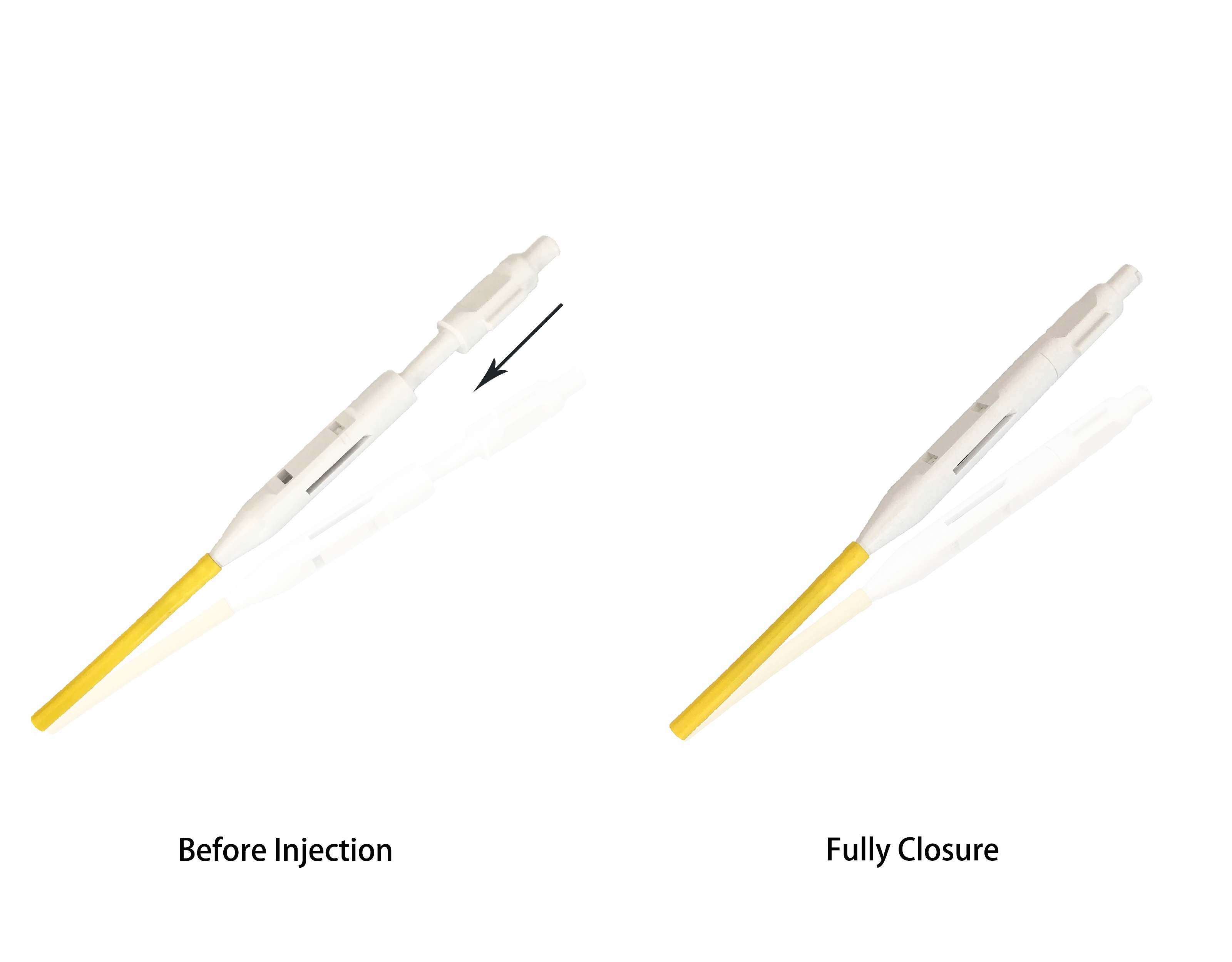 2300mm Sclerotherapy Endoscopic Injection Needle Disposable