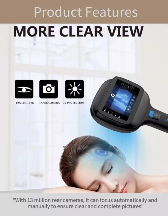 Medical Dermatology Woods Lamp Skin Analysis Veterinary 9000A