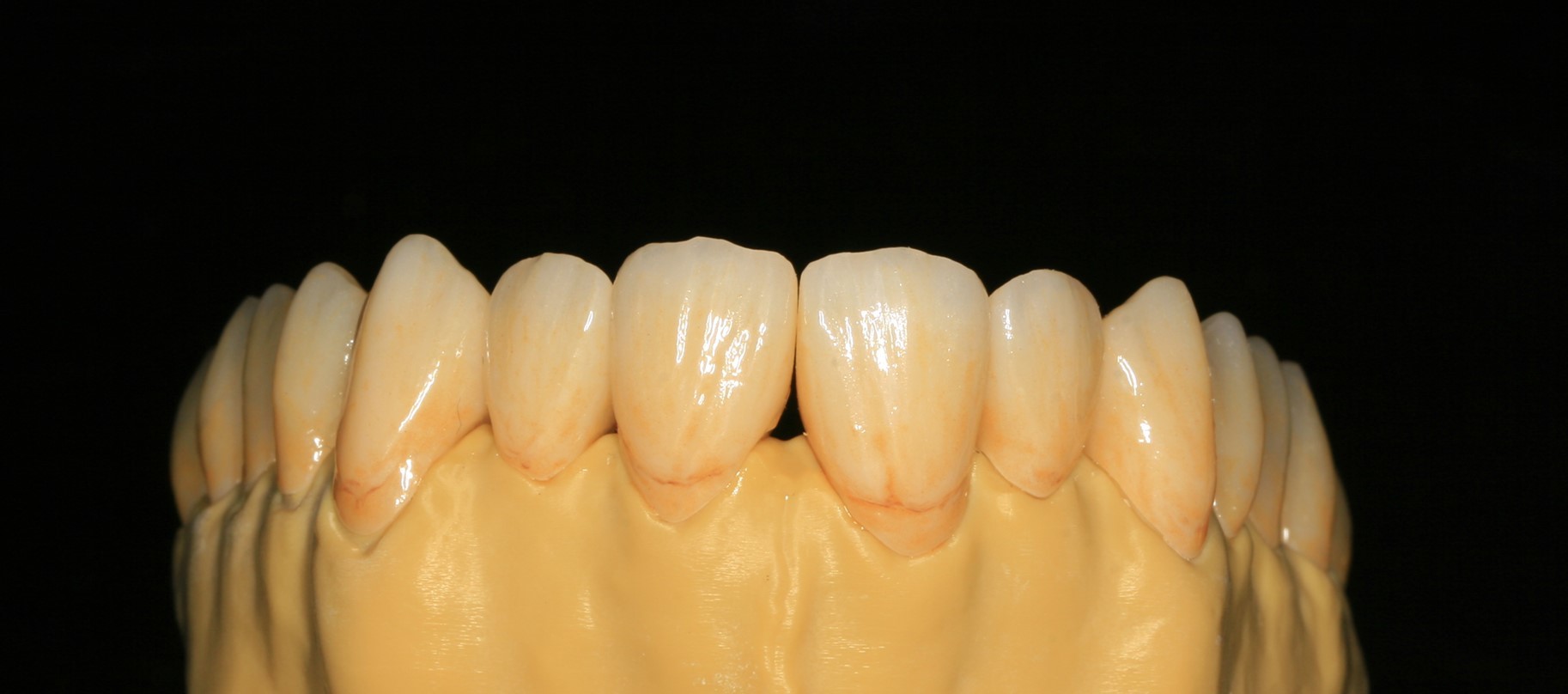 Design Dental Lab Monolithic Zirconia Dental Crown For Molars Posterior Teeth