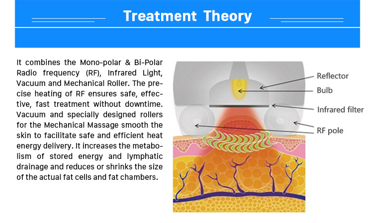 beijing cryo cryolipolysis roller prezzi equipamentos slimming precio del equipo