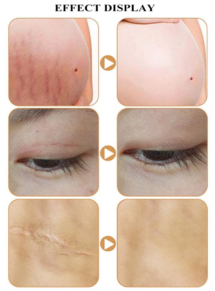 ODM 15ml Permanent Makeup Pigments Remove Skin Care Products