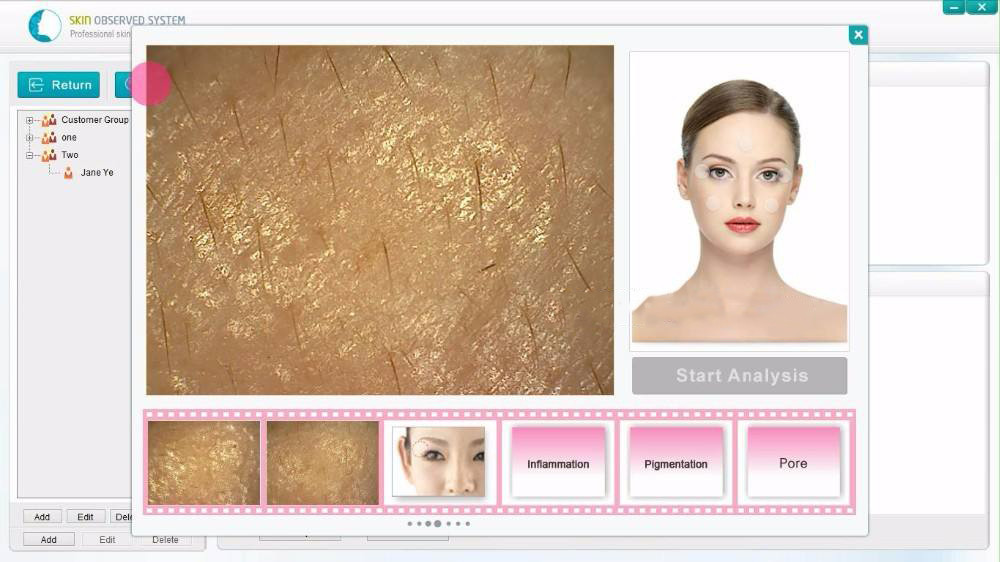 USB 5V UV Handheld Skin Analyzer 5.0 Mega Face Scanner For Skin Care