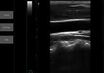 Ultrasound Scan Equipment Portable Ultrasound Scanner Palm Ipad Ultrasound Machine