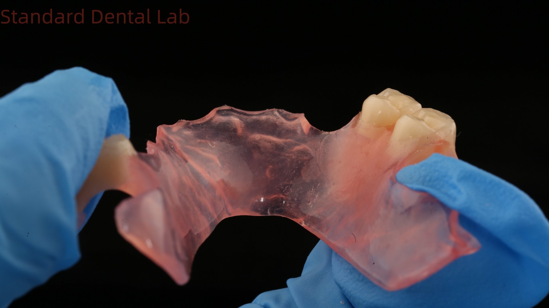 Dental TCS Valplast Flexible Partial Dentures Dental Lab 3D Print Model High Esthetics