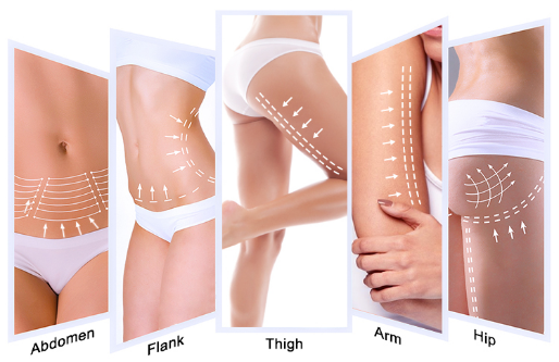 Multifunctional HIFU Machine For Vagina Tightening And V-Line Lifting