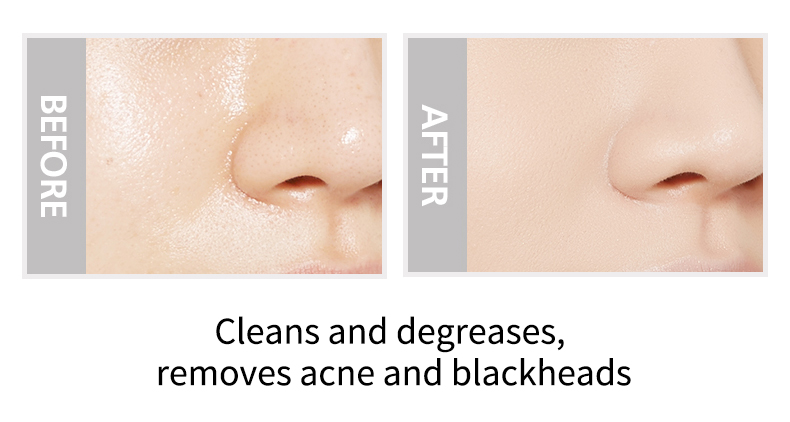 Acne Blackhead 1kg Volcanic Dead Clay Mask OEM Private Label