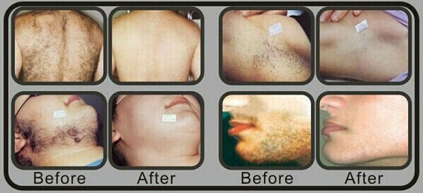 before-after 1.jpg