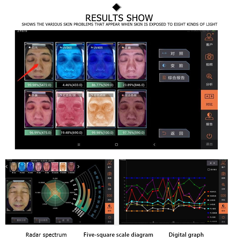 japan software magnifier beauty machine mirrorskin testing 3d digital mobile skin facial analyzer for Skin Mositure