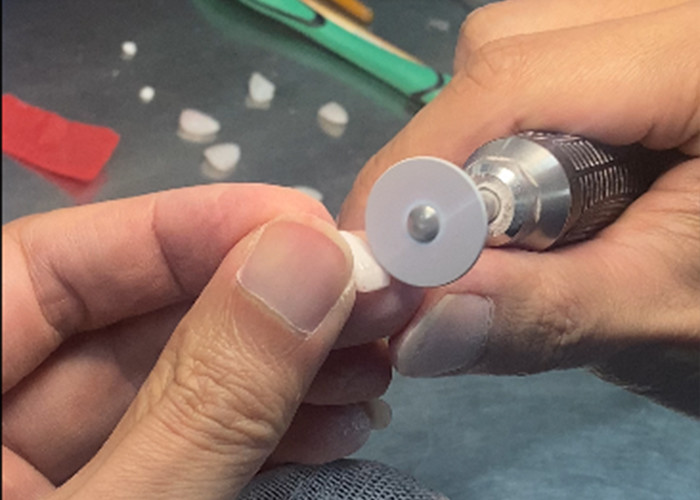 Precision Crafted IPS e.max Veneers for Unrivaled Smile Transformations Delivering Exceptional Durability Aesthetics