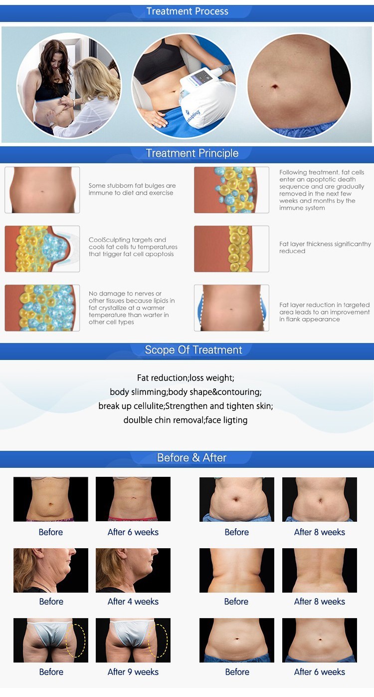Professional cryolipolysis system air pressure body slimming for whole body cryo liposuction machine
