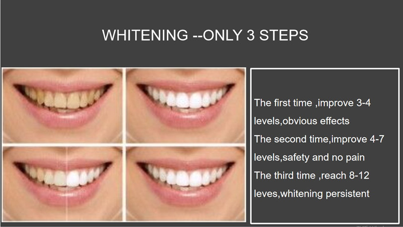 Teeth Whitening For Home Use Made In China Best Quality Whitening Kit