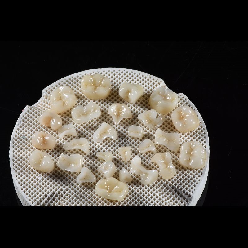 Dental Restorations IPS EMax Inlay Onlay All Porcelain Highly Durable
