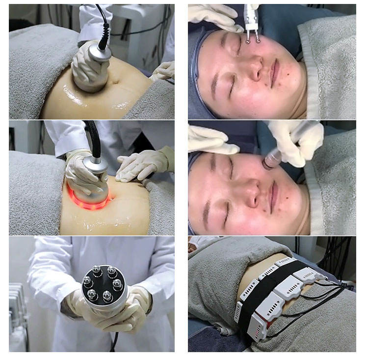 4D 4 In 1 RF Photon Ultrasonic Cavitation Machine Sculpting Skin Tightening