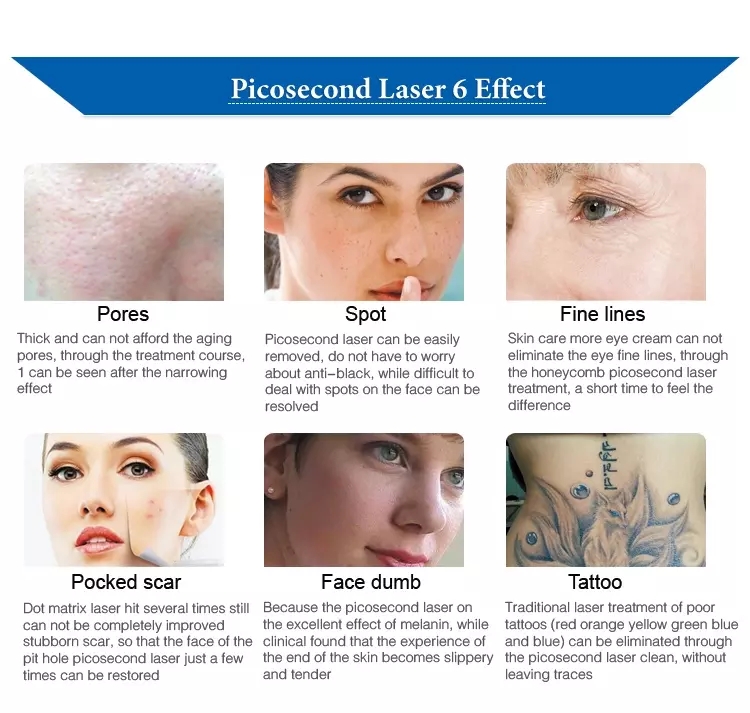 808nm Nd Yag Laser Machine , 2 In 1 Skin Rejuvenation Picosecond Laser Machine