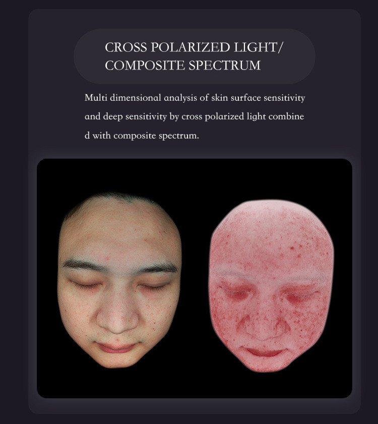 Professional Skin Analyzer Machine AI Powered Skin Diagnosis Machine