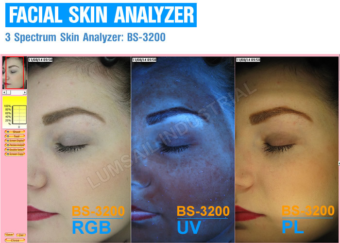 3D facial 8,800 Lux high resolution Epidermal skin analysis machine