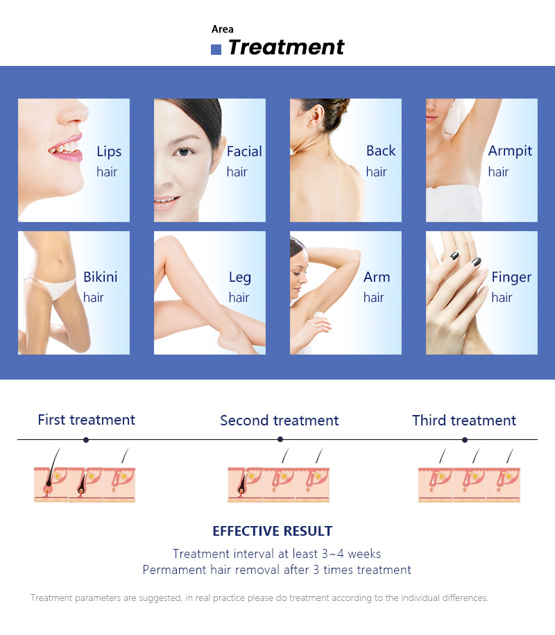 3500W 808 Nm Diode Laser Hair Removal Machine Hair Loss Treatment Machine