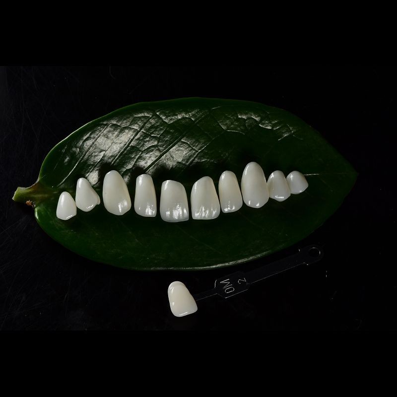 Natural Looking Aesthetic Ceramic Emax Veneer Dental Material Customized