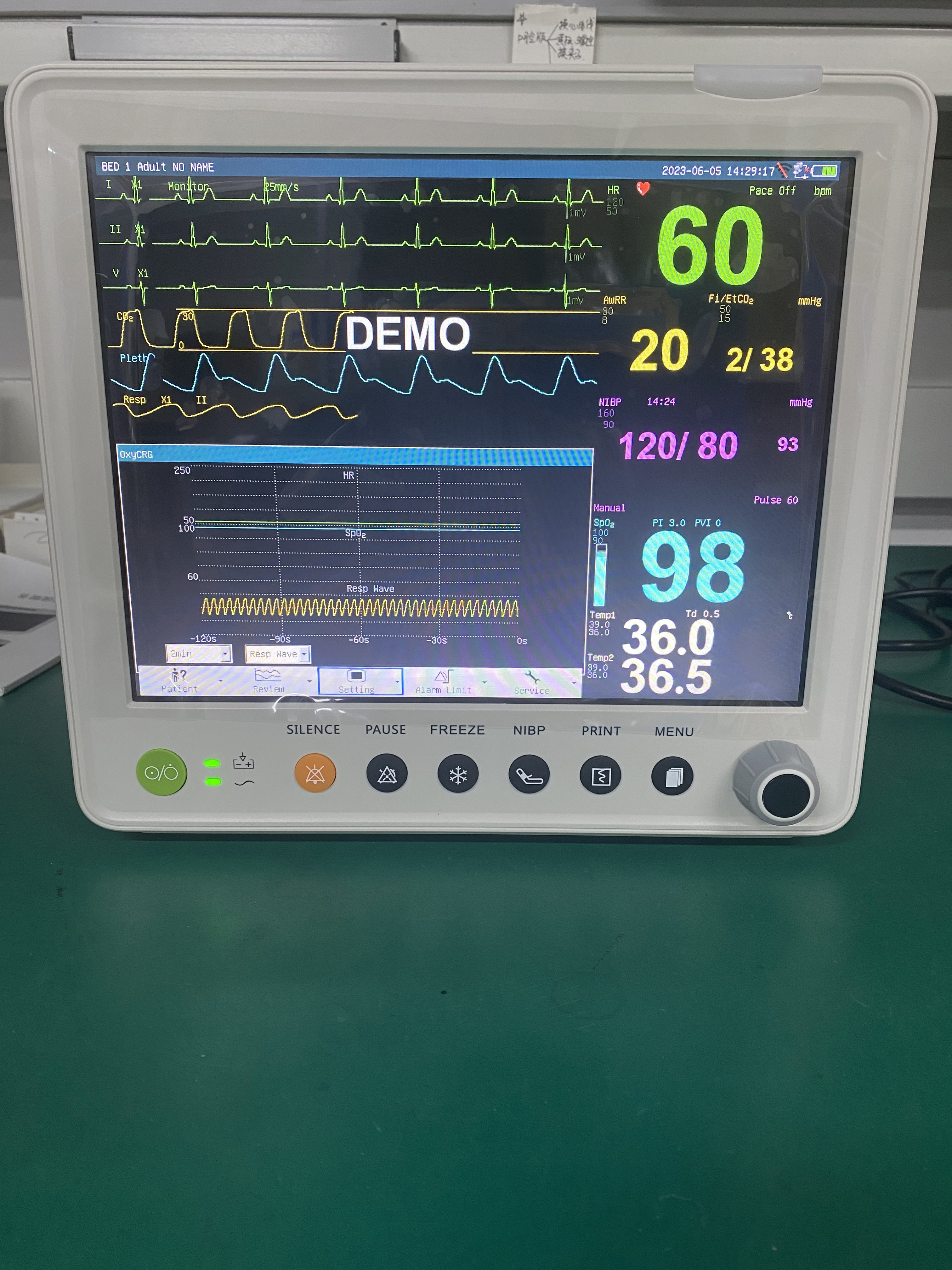 Portable Patient Monitor With Parameters Of ETCO2 ECG NIBP SPO2 RESP TEMP PR