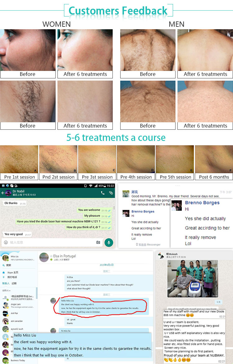 CE ISO Approved 2018 new permanent 808nm hair removal diode laser