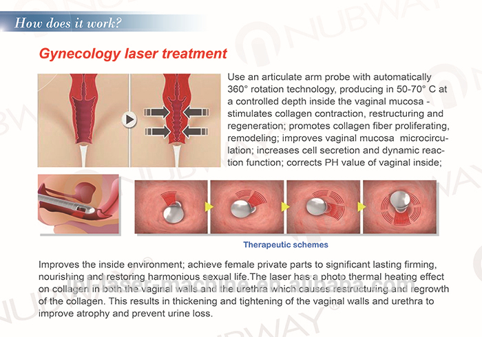 fractional co2 laser.jpg