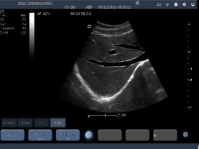 Portable Ultrasound Machine Probes Wireless Ultrasound Probe with 2~11MHz Frequency 160g Weight Only
