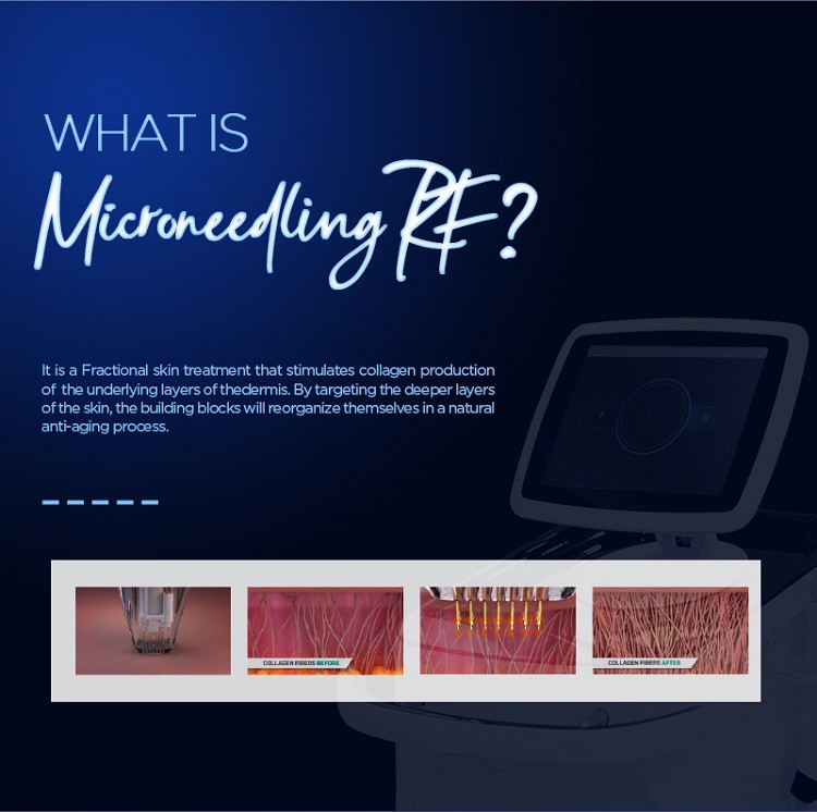 Spa Salon Skin Rejuvenation Machine 1MHz Microneedle Fractional RF Machine