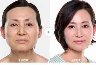Leadbeauty 5 treatment heads HIFU face lift machine / HIFU face lift device for wrinkle removal with big 15 inch screen