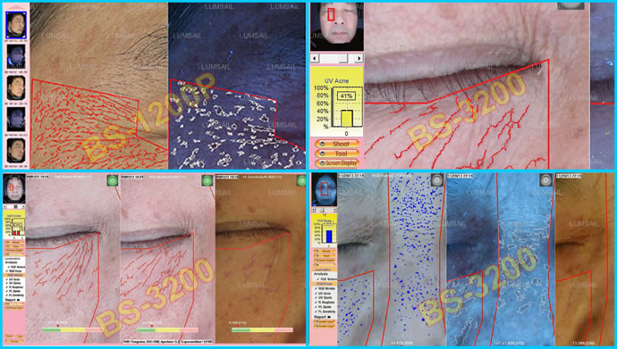 UV / PL Light Skin Analysis Equipment For Skin Care With 3: 4 Preview System