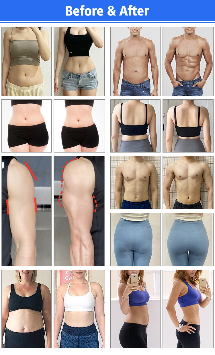 800W-3500W Body Sculptor Machine 10D Laser HIEMT Body Sculpt Machine For Tightening / Slimming