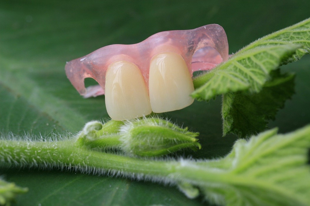 Soft Elastic Nylon Trushine Invisible Denture