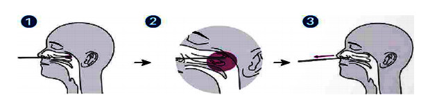 One Step 5 Minute Antigen Test convenient TS20201201 Certificated