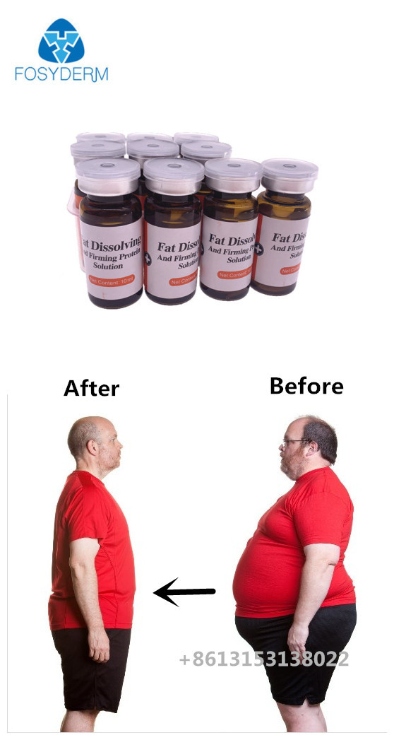 Hyamely Linquid Loss Slimming Injection Lipolysis Fat Dissolving