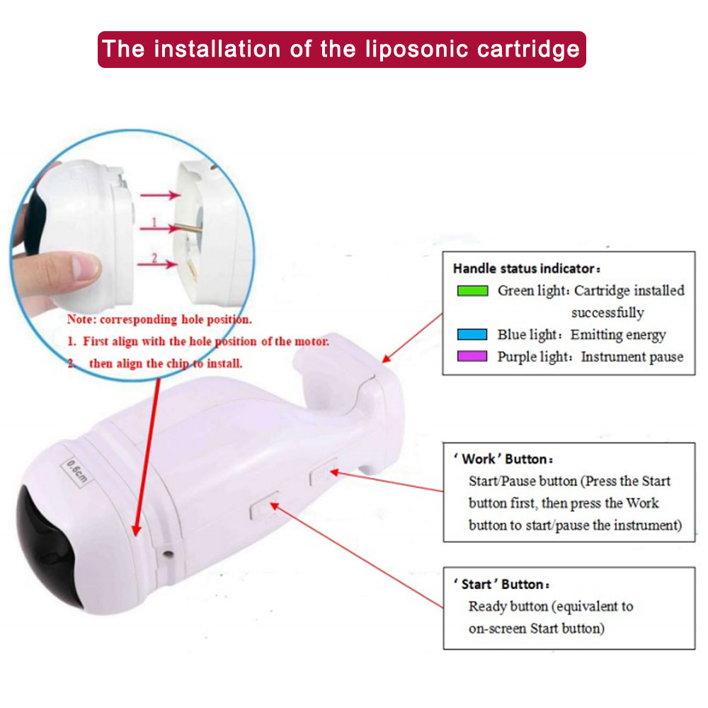 Focused Ultrasound SMAS Lifting Machine 7D 2 In 1 HIFU Slimming Liposonix