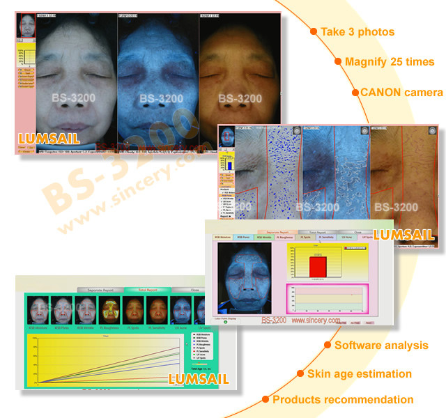 UV / PL Light Skin Analysis Equipment For Skin Care With 3: 4 Preview System
