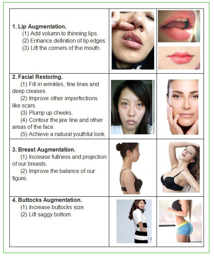High Quality Beauty Products Hyaluronic Acid Syringe filler