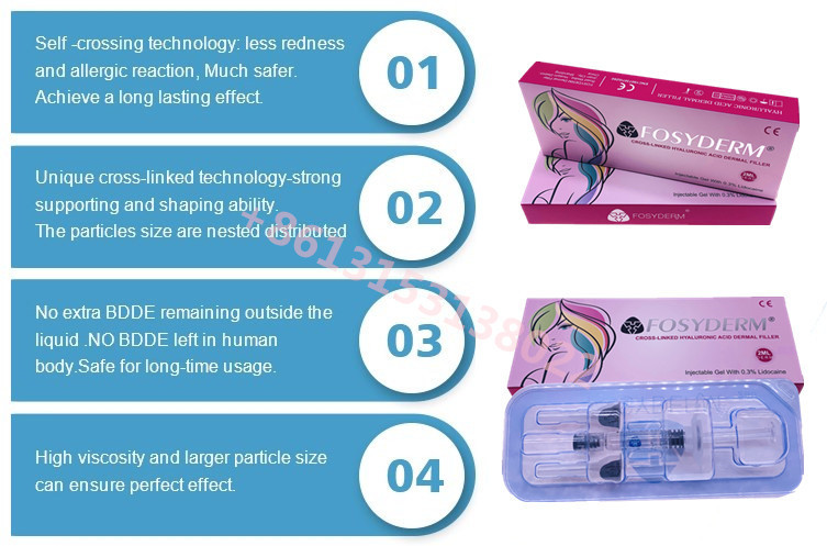 Fosyderm Hyaluronic Acid Non Invasive Lip Filler Cross Linked HA Fillers