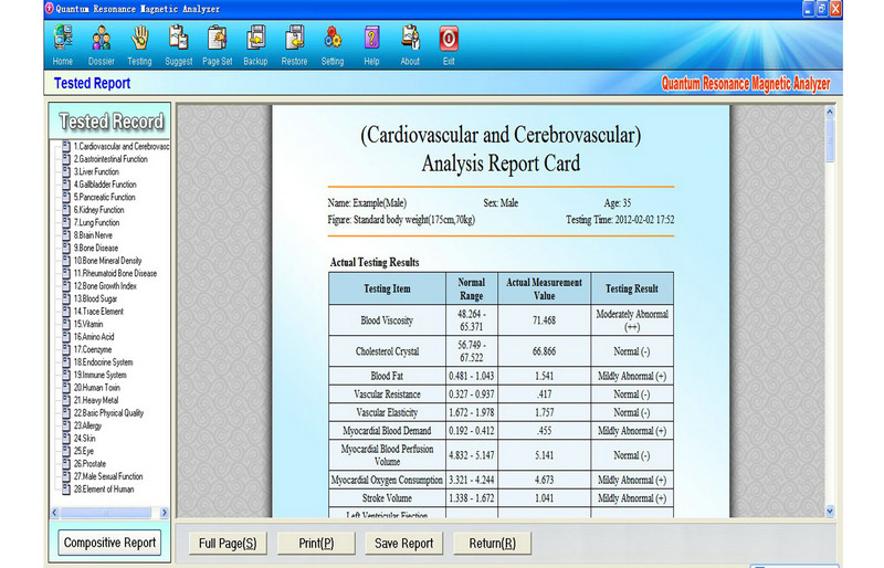 French USB Quantum Health Test Machine 38 Reports Protable
