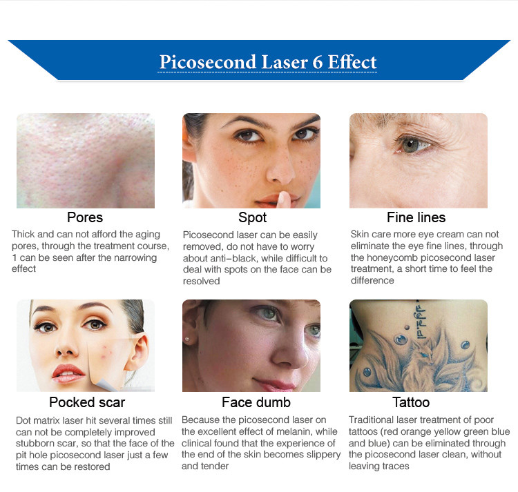 Honeycomb Picolaser Melasma Carbon Peel Tattoo Removal Machine 600ps 1064nm