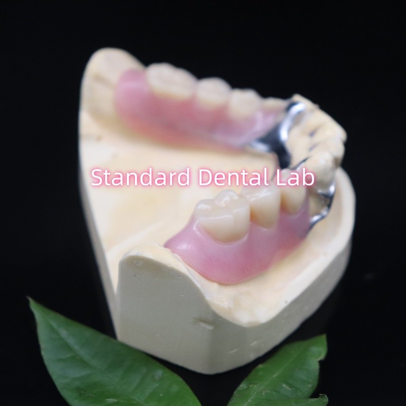 Clear framework Acrylic Metal Partial Denture Frameworks High Esthetics China dental lab