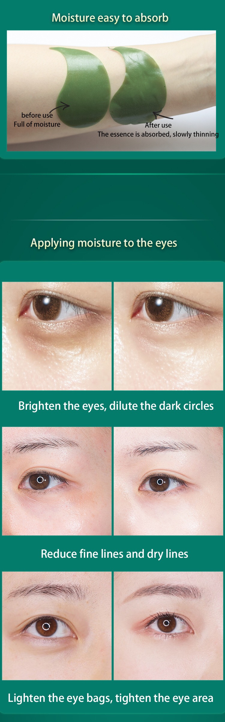 Hyaluronic Acid Eye Gel Pads For Dark Circles OEM Skin Care Products